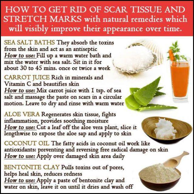 Natural Way to Get Rid of Scar Tissue and Stretch Marks